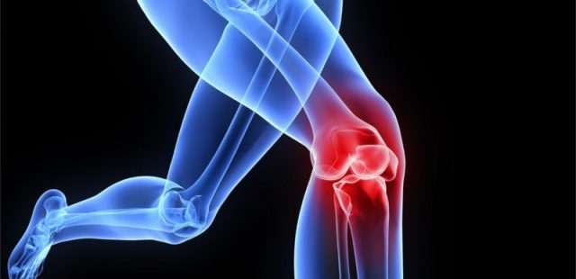 6 Things You Should Consider Knowing About Knee Replacement Surgery