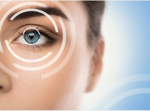 lasik